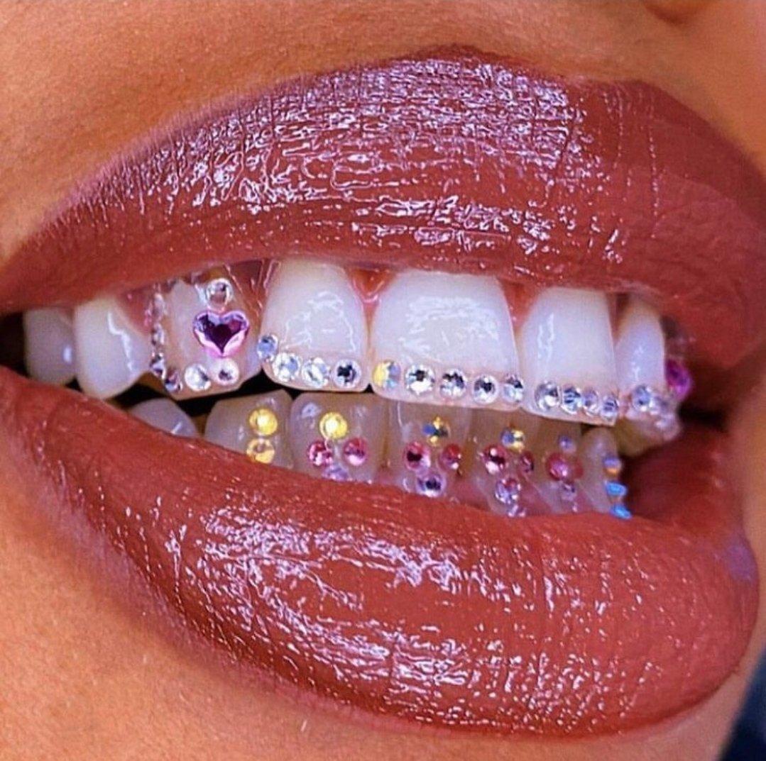 The Best Tooth Gem Designs