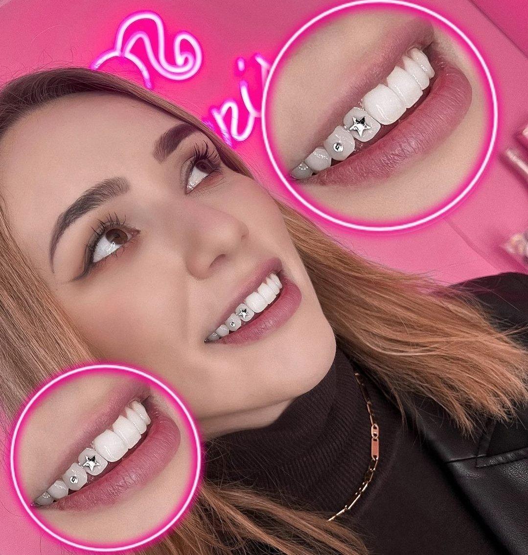 Tooth Gems' Is The New Hot Beauty Trend and I Don't Hate Them
