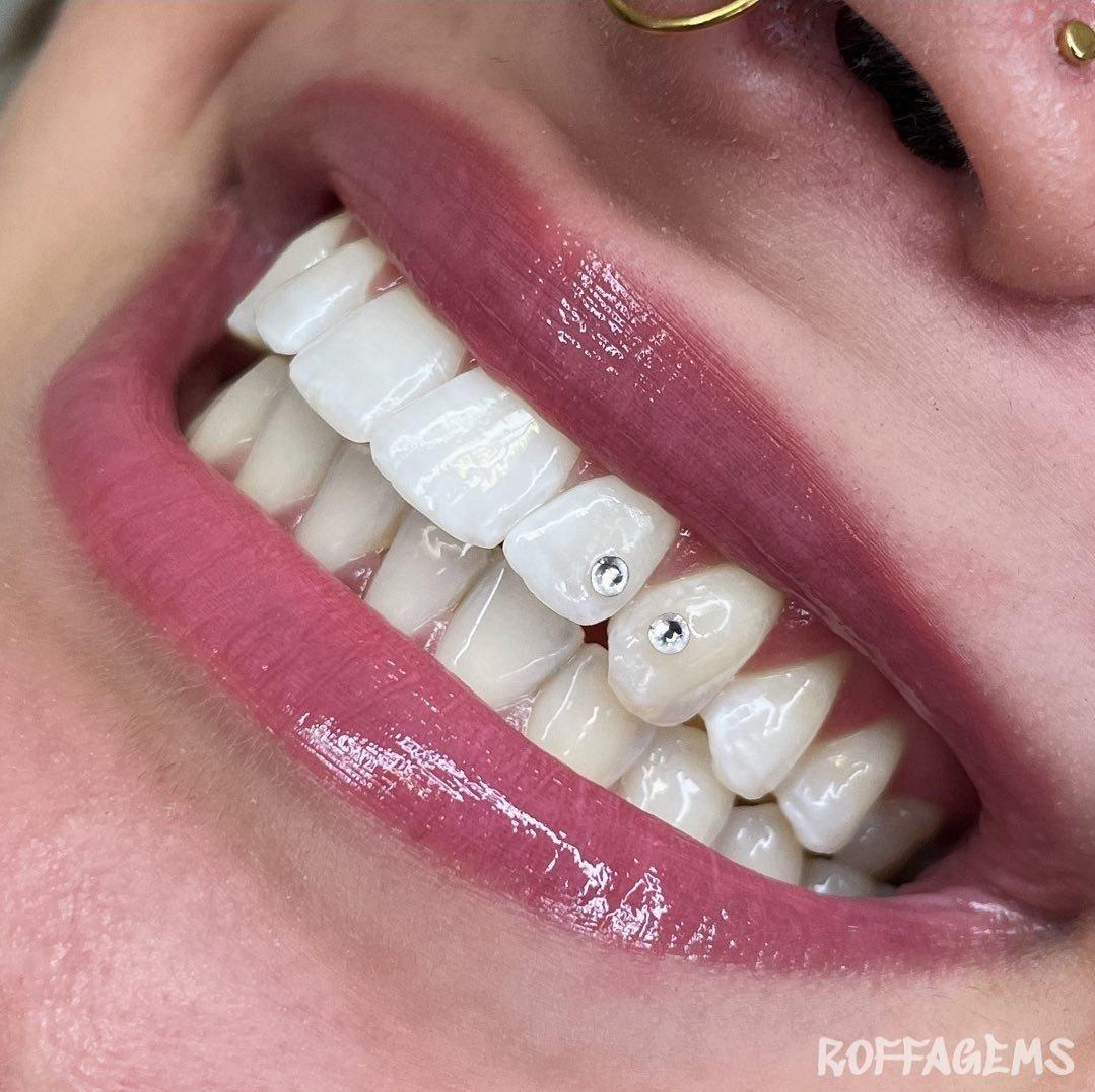 Tooth Gems World
